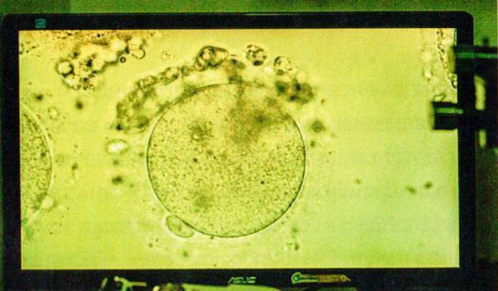 На мониторе, подсоединенномк микроскопу, — созревшая яйцеклетка